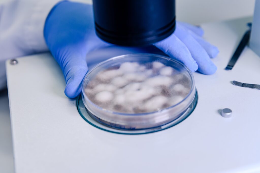 Mould-Spore-Count